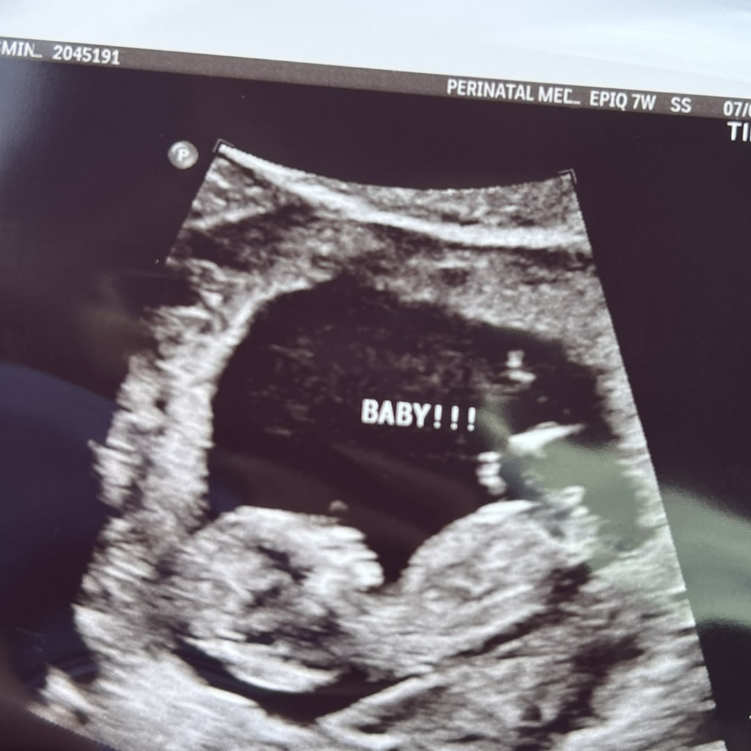 Photo shared by Jasmine for their Babylist baby registry.