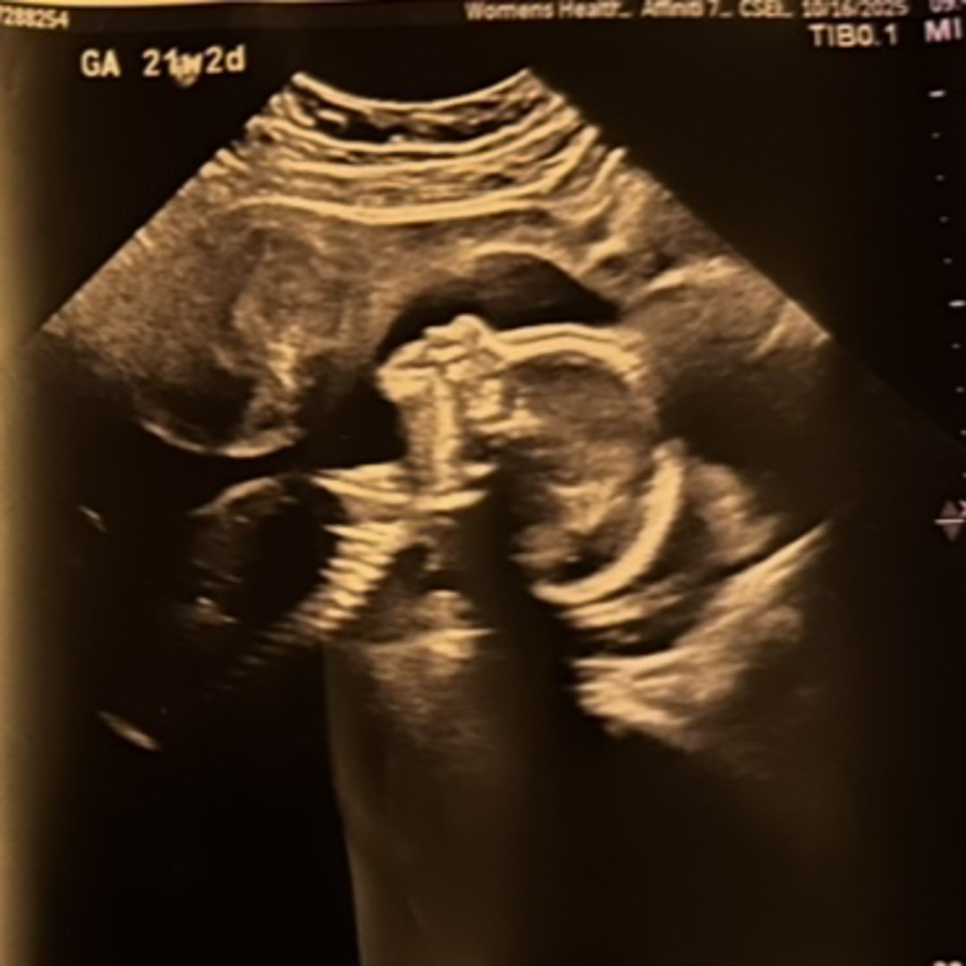 Photo shared by Megan for their Babylist baby registry.