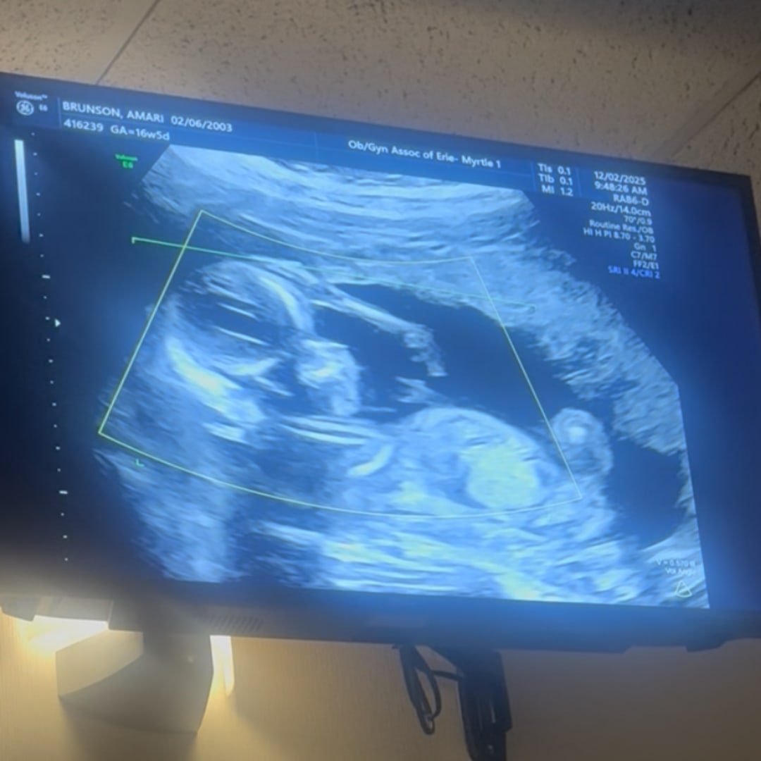 Photo shared by Amari for their Babylist baby registry.