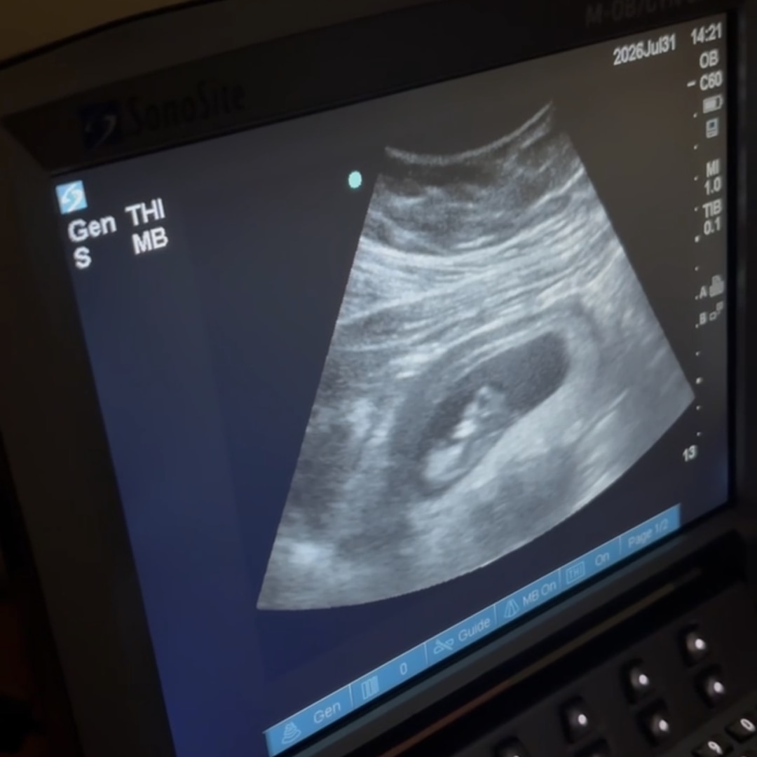 Photo shared by Emily for their Babylist baby registry.