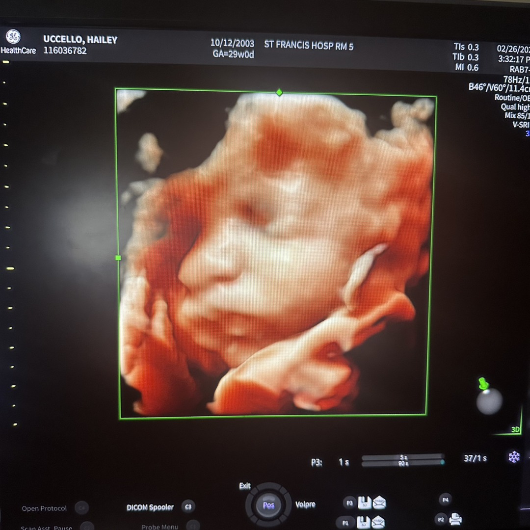 Photo shared by Hailey for their Babylist baby registry.