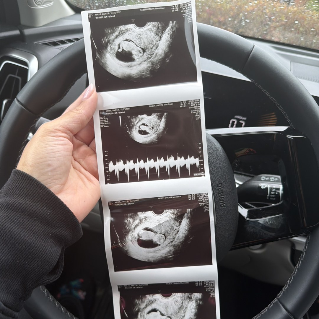 Photo shared by Amelia for their Babylist baby registry.