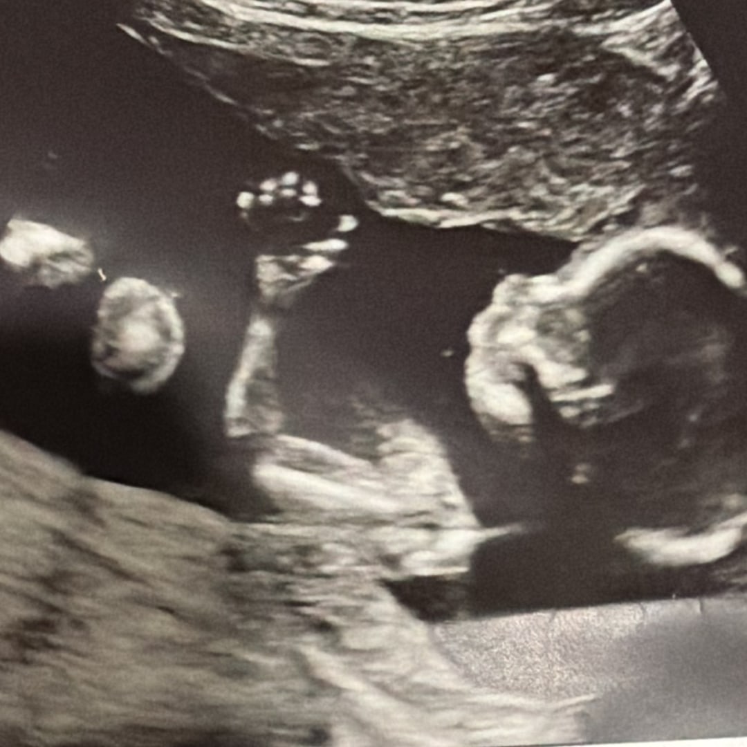 Photo shared by Alex for their Babylist baby registry.