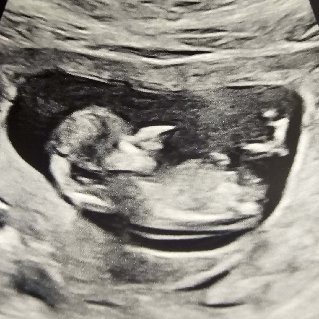 Photo shared by Samantha for their Babylist baby registry.