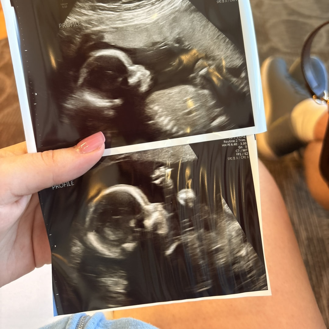 Photo shared by Caroline for their Babylist baby registry.