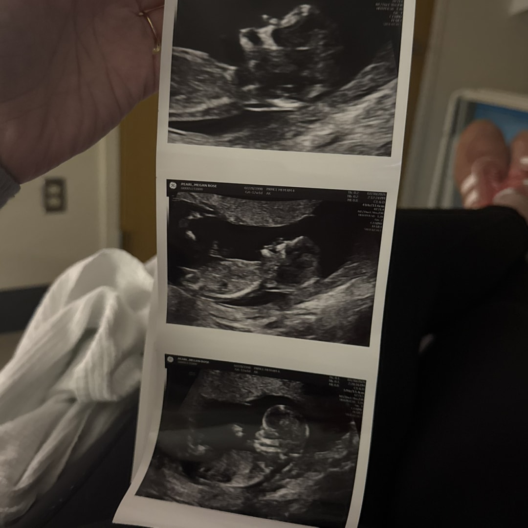 Photo shared by Megan for their Babylist baby registry.