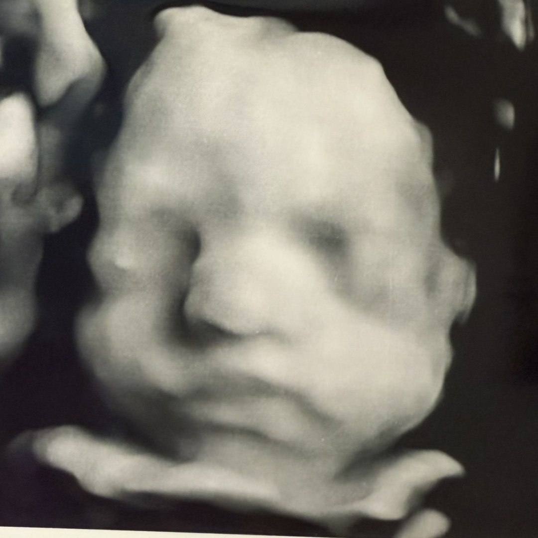 Photo shared by Morgan for their Babylist baby registry.