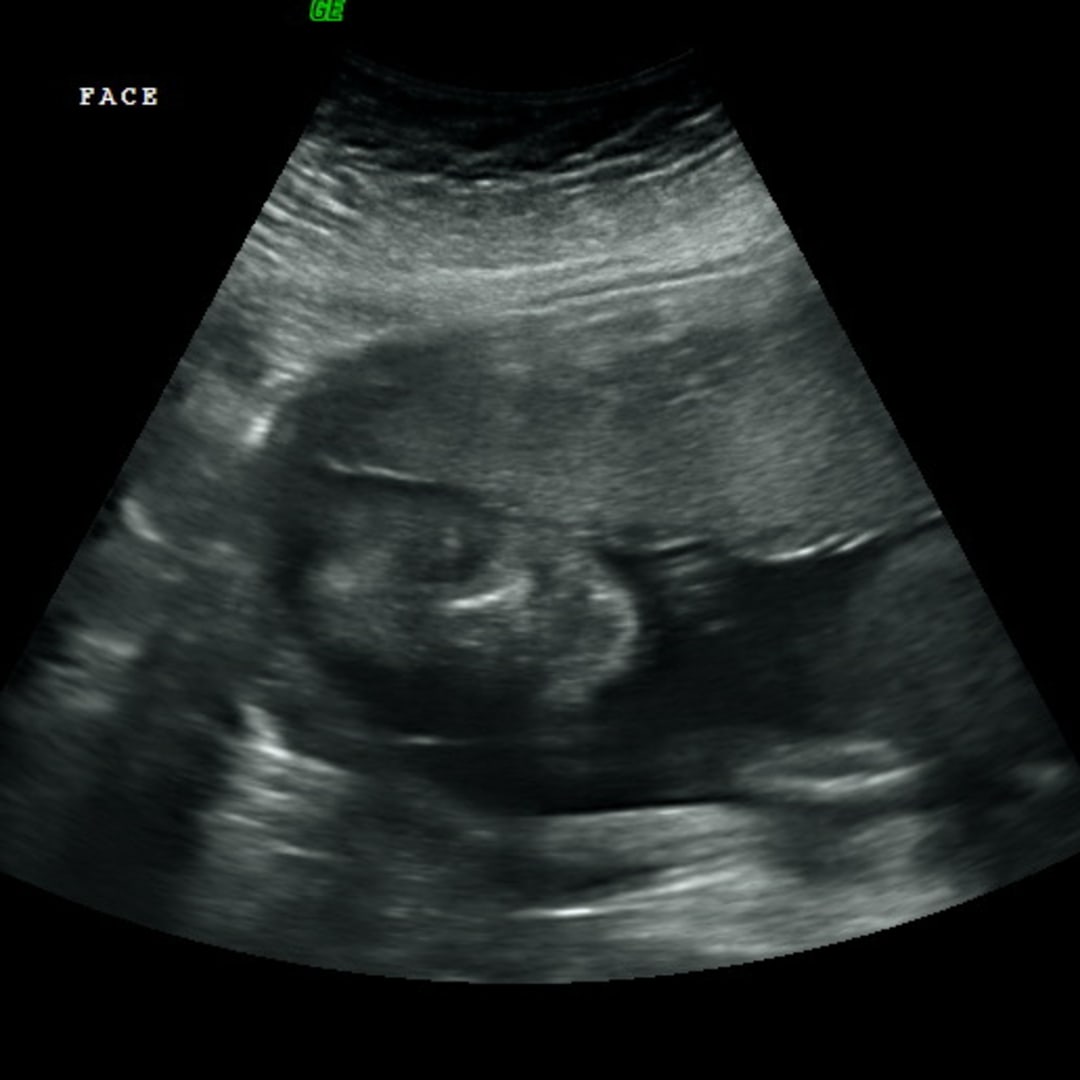 Photo shared by Chatney for their Babylist baby registry.