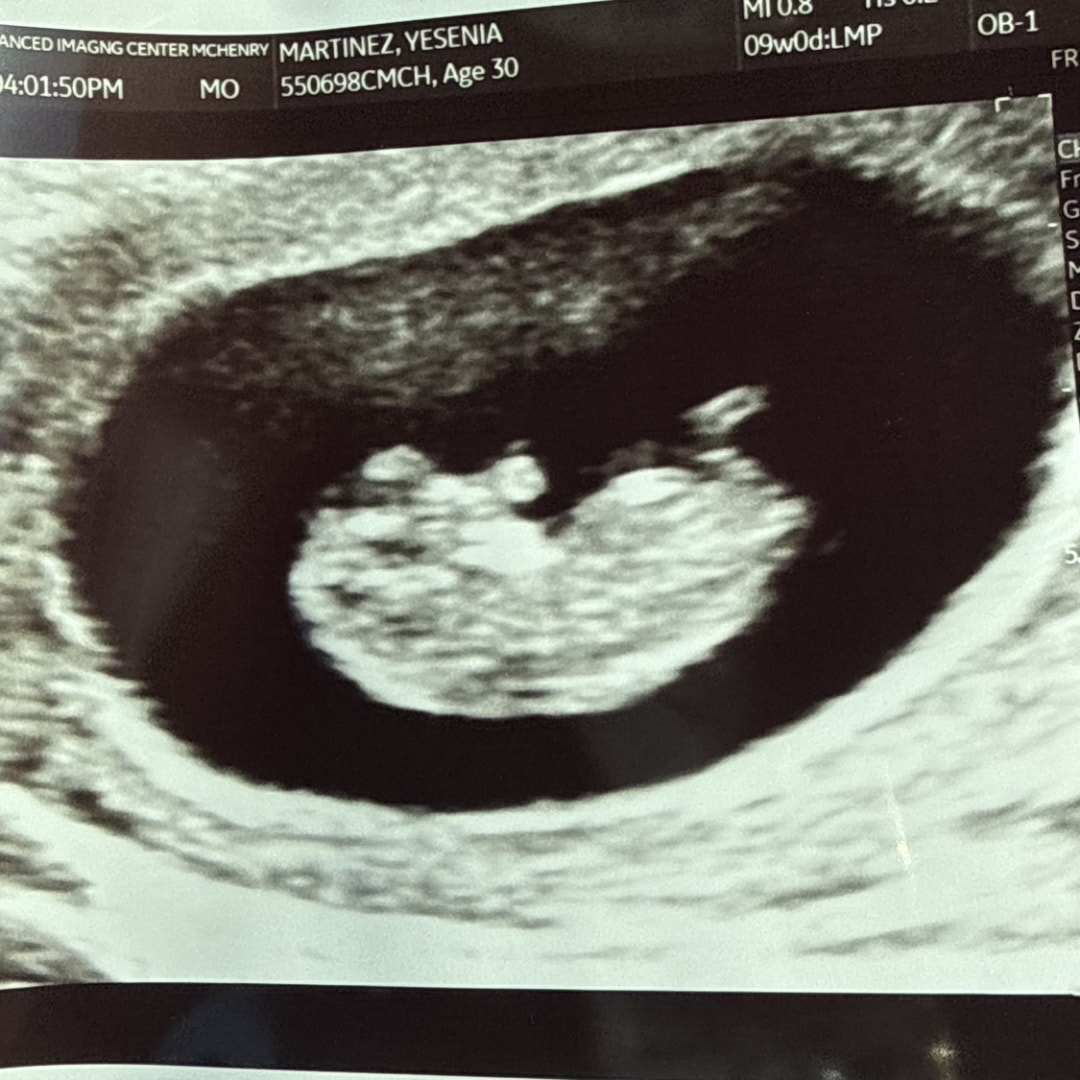 Photo shared by Yesenia for their Babylist baby registry.