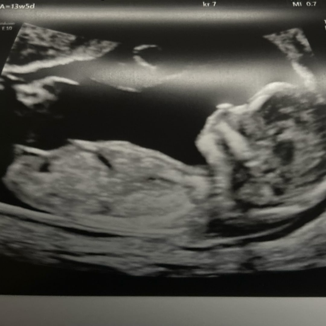 Photo shared by Allison for their Babylist baby registry.