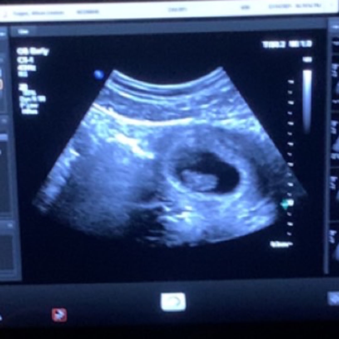 Photo shared by Allison for their Babylist baby registry.