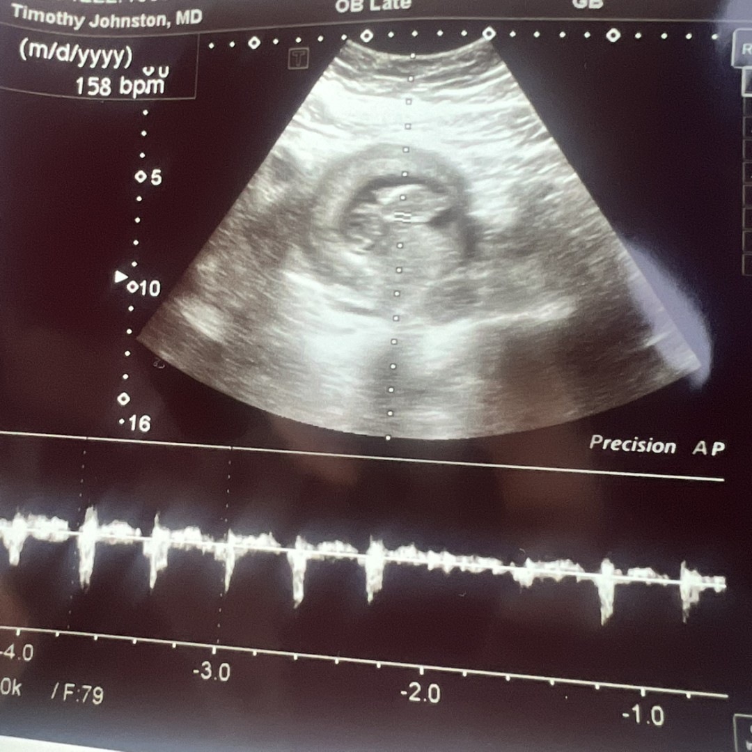 Photo shared by Jacqueline for their Babylist baby registry.