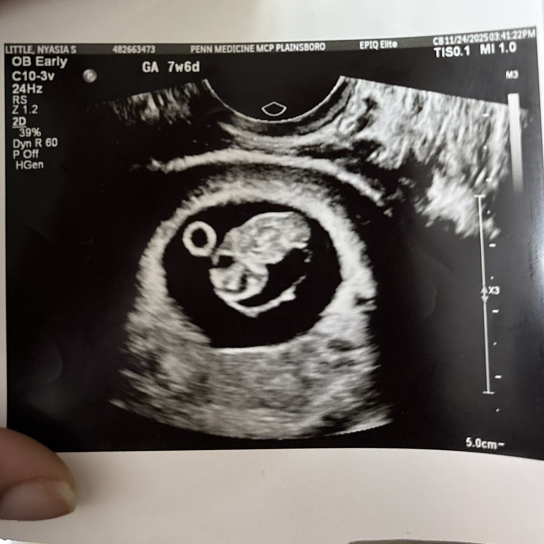 Photo shared by Nyasia for their Babylist baby registry.