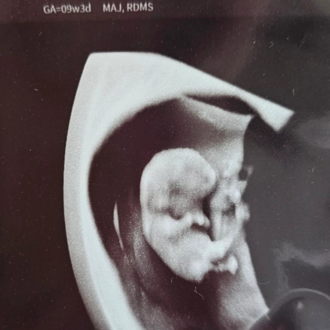 Photo shared by Janna for their Babylist baby registry.