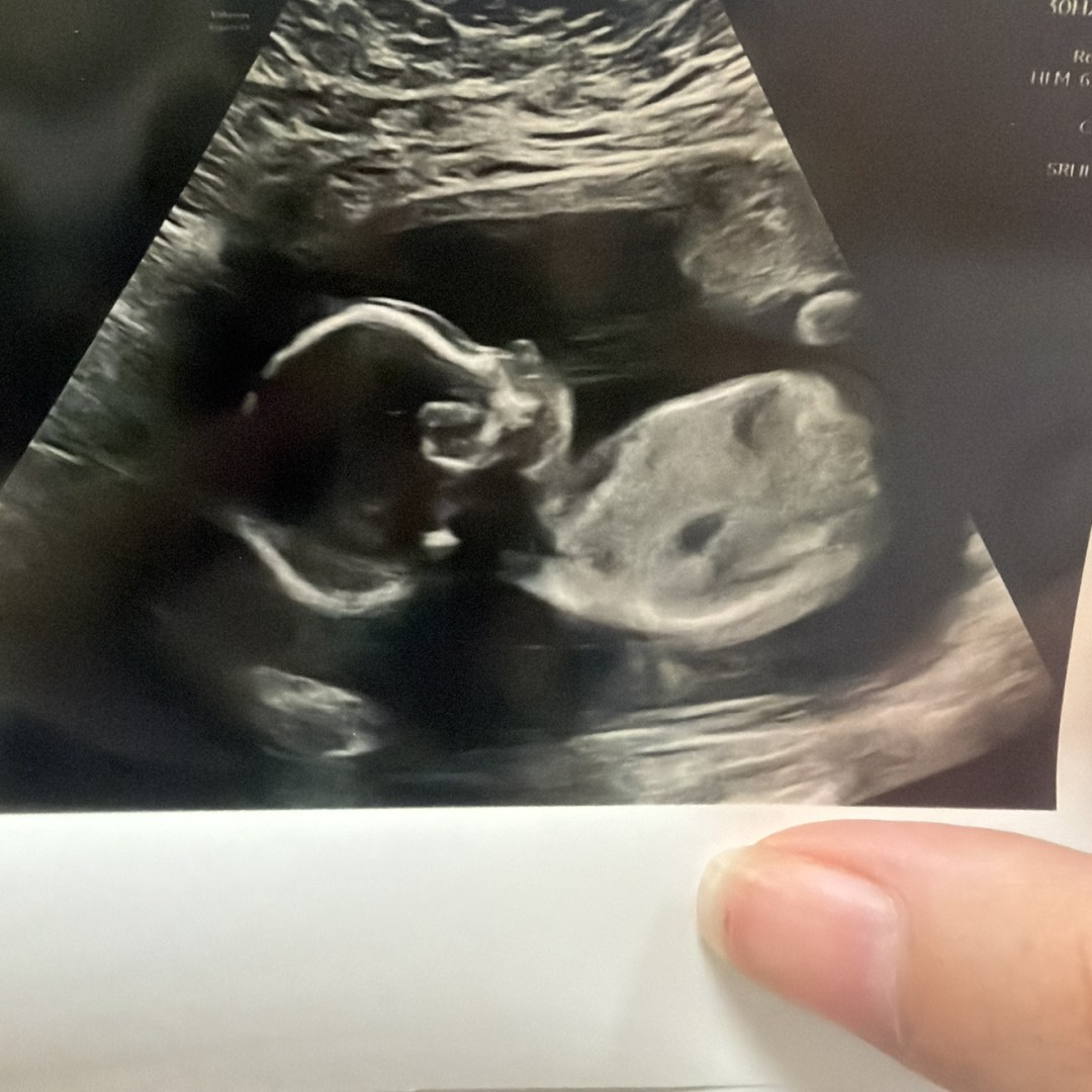 Photo shared by Marissa for their Babylist baby registry.