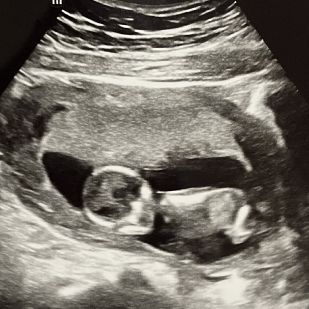 Photo shared by Katie for their Babylist baby registry.