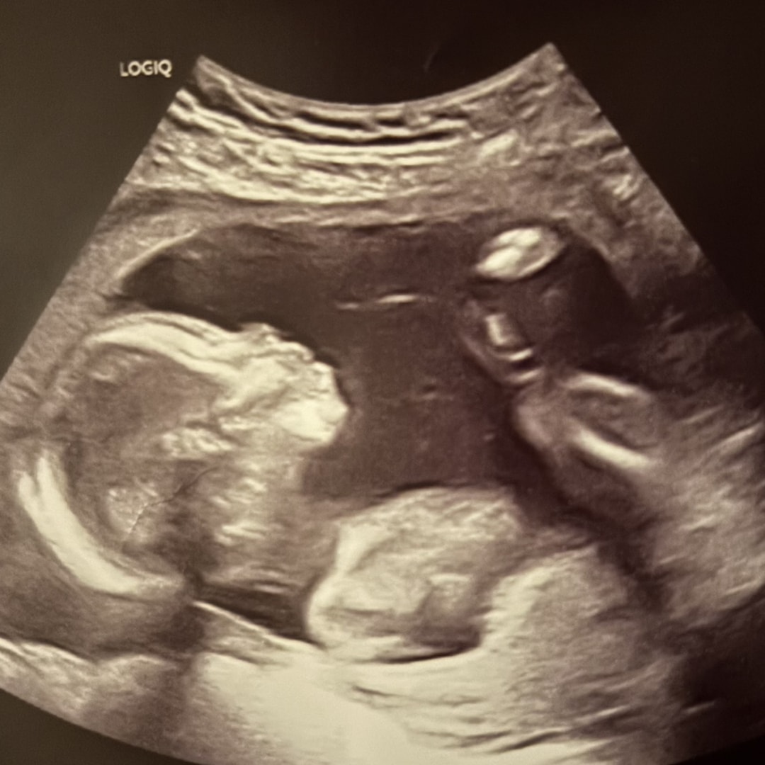 Photo shared by Alexis for their Babylist baby registry.