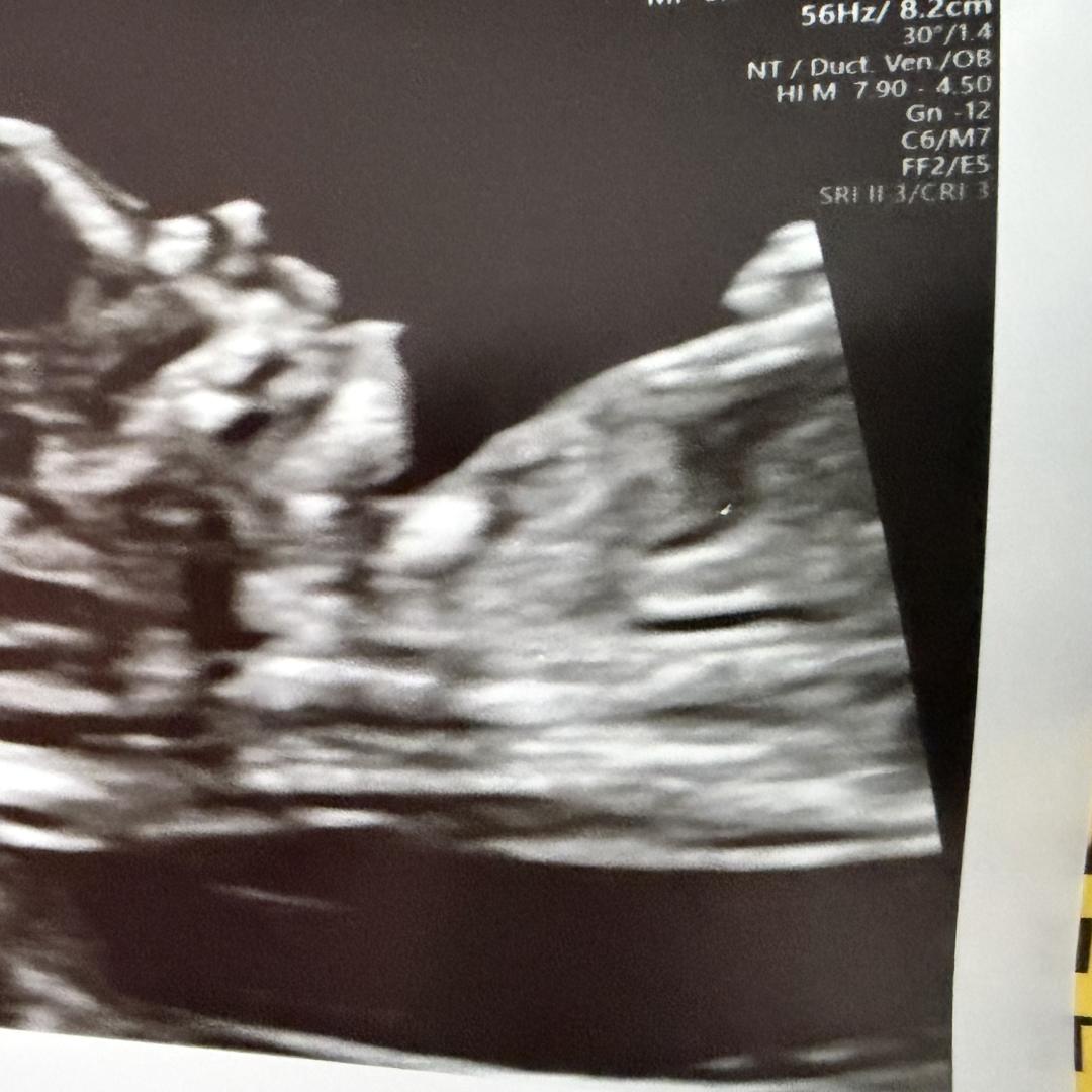 Photo shared by Alexandra for their Babylist baby registry.