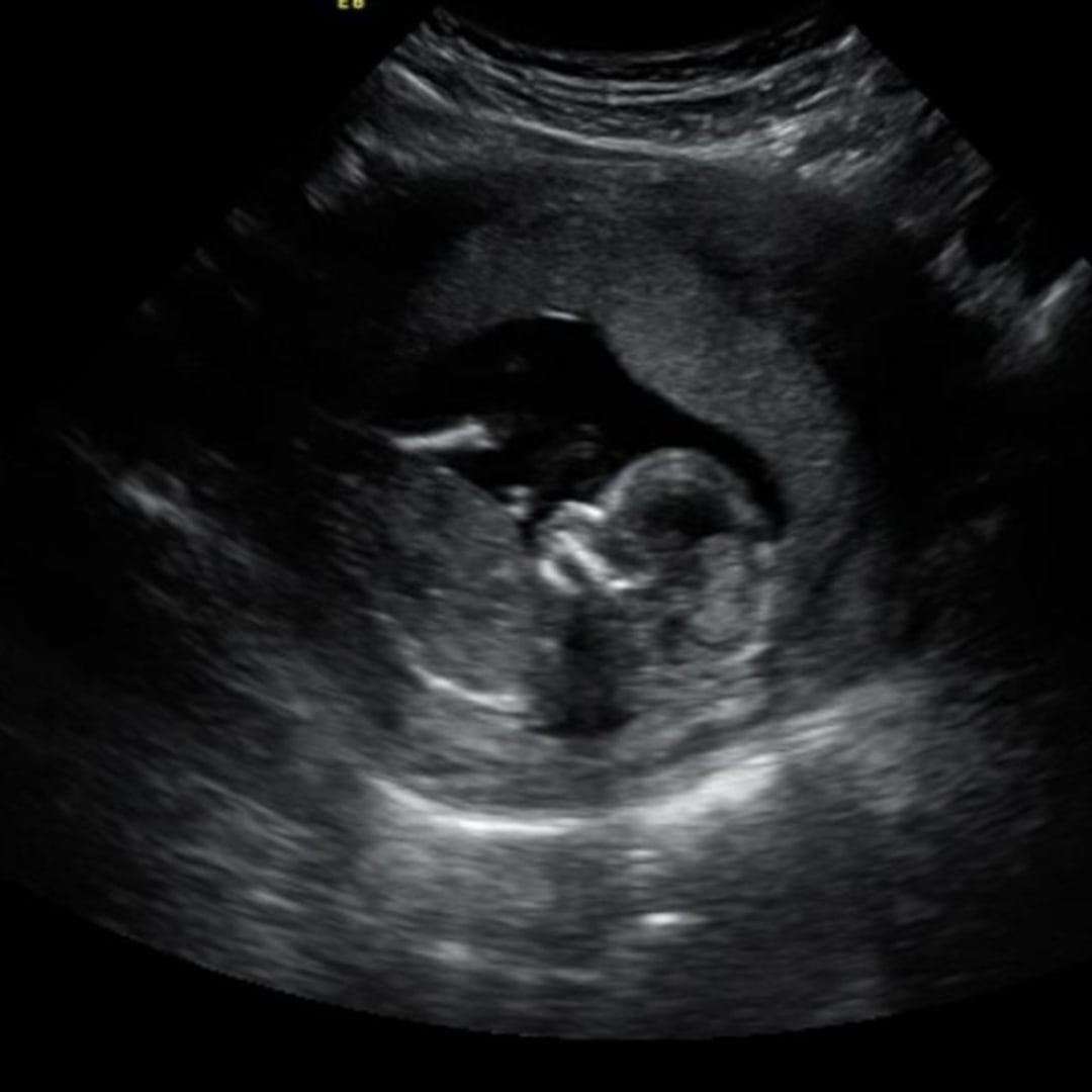 Photo shared by Vanity for their Babylist baby registry.