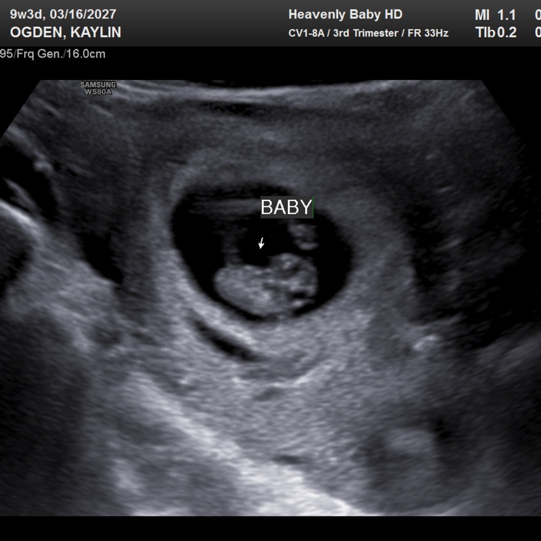 Photo shared by Kaylin for their Babylist baby registry.