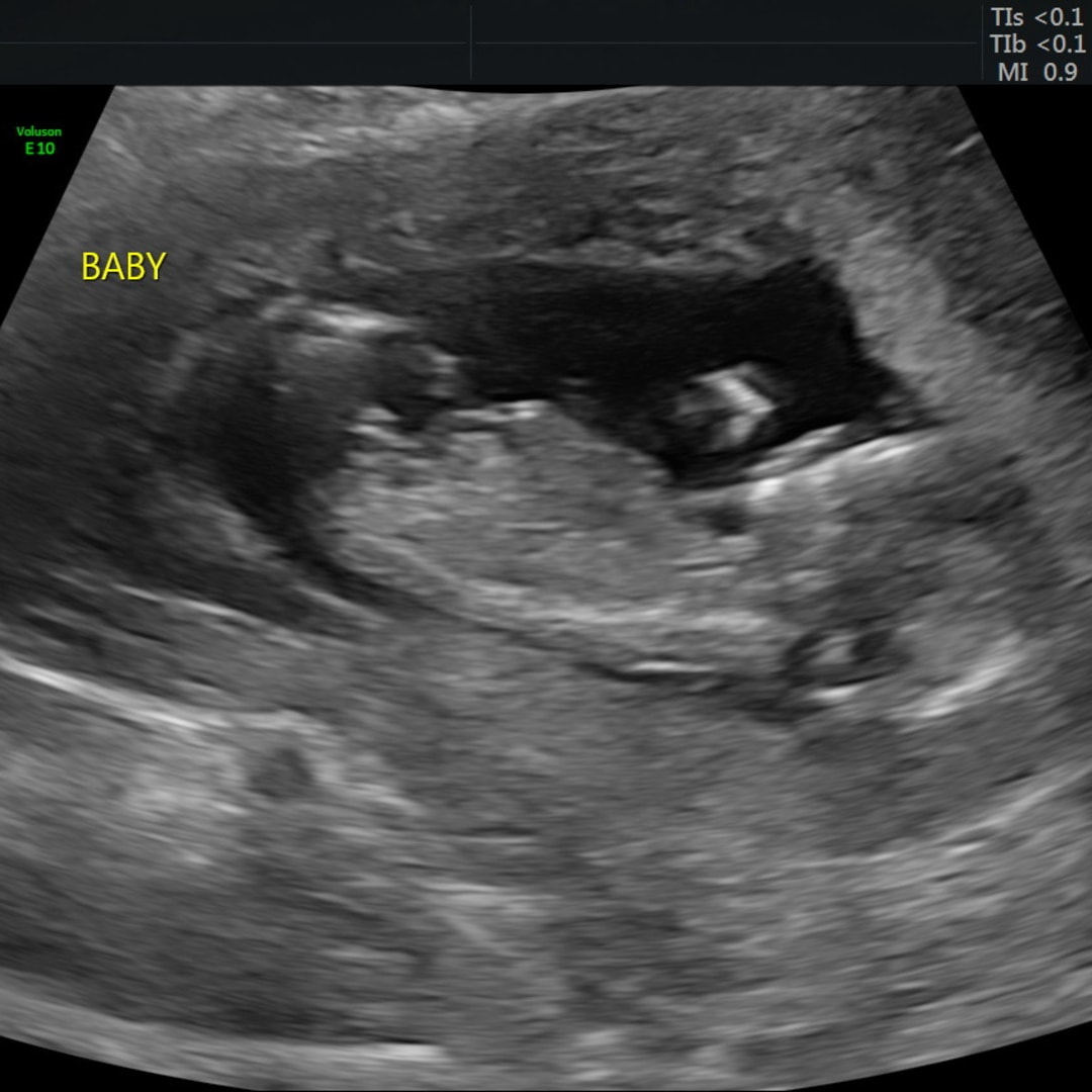 Photo shared by Emily for their Babylist baby registry.