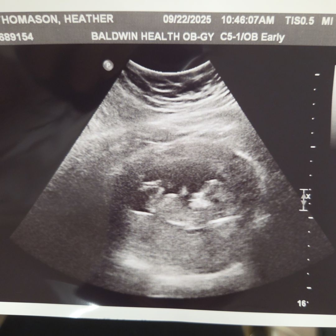 Photo shared by Heather for their Babylist baby registry.