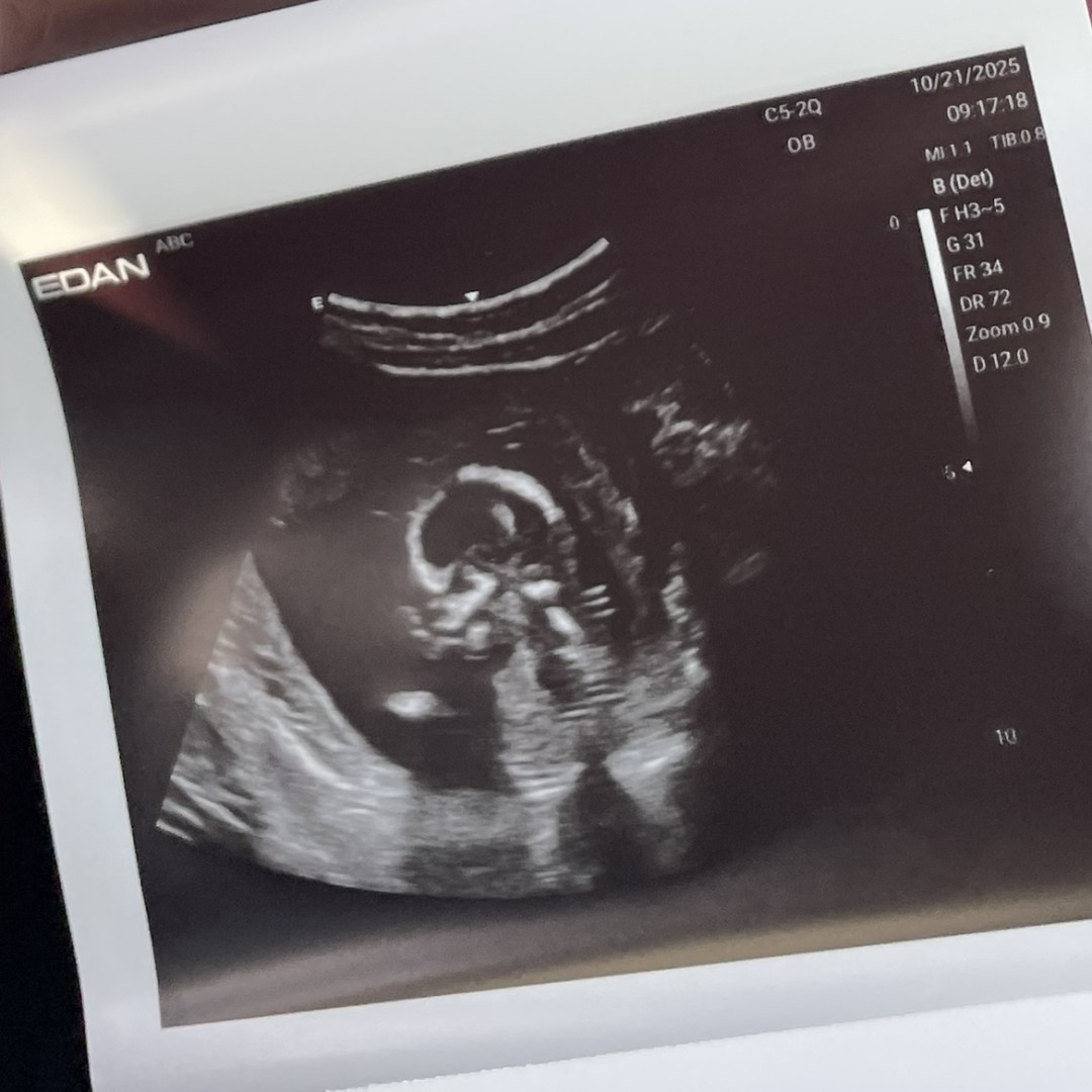 Photo shared by Ashauntie for their Babylist baby registry.