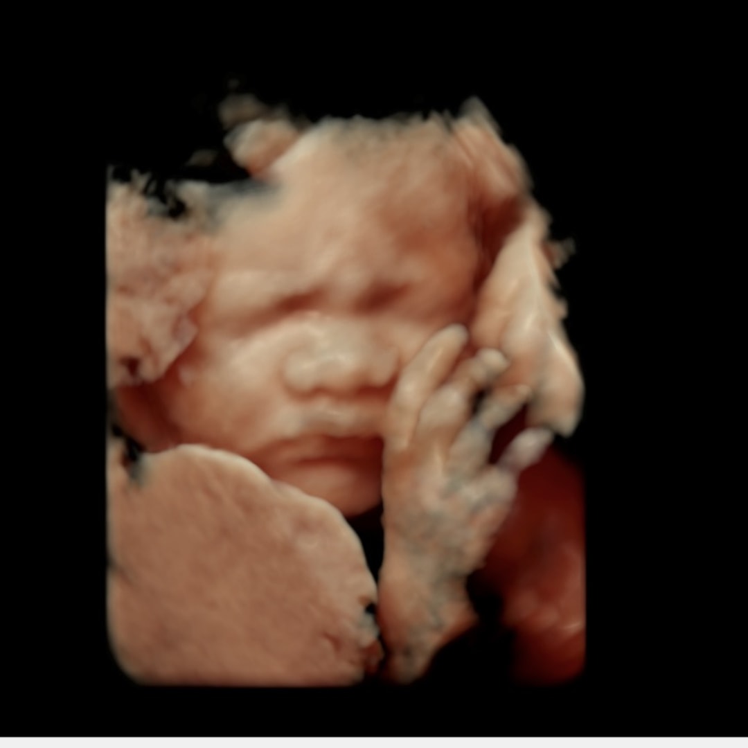 Photo shared by Jeizhelle for their Babylist baby registry.