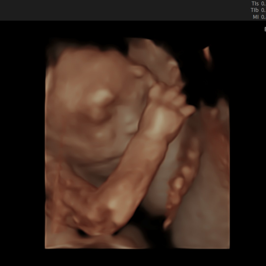 Photo shared by Connie for their Babylist baby registry.