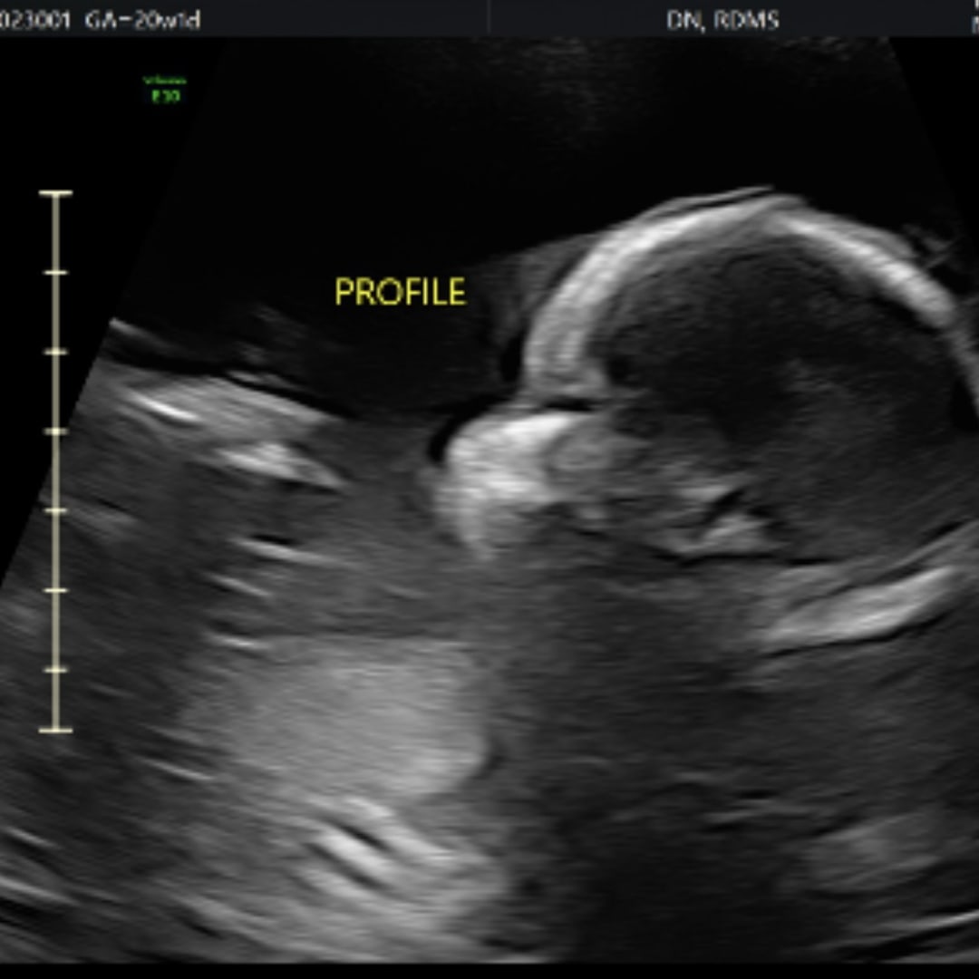 Photo shared by Hope for their Babylist baby registry.