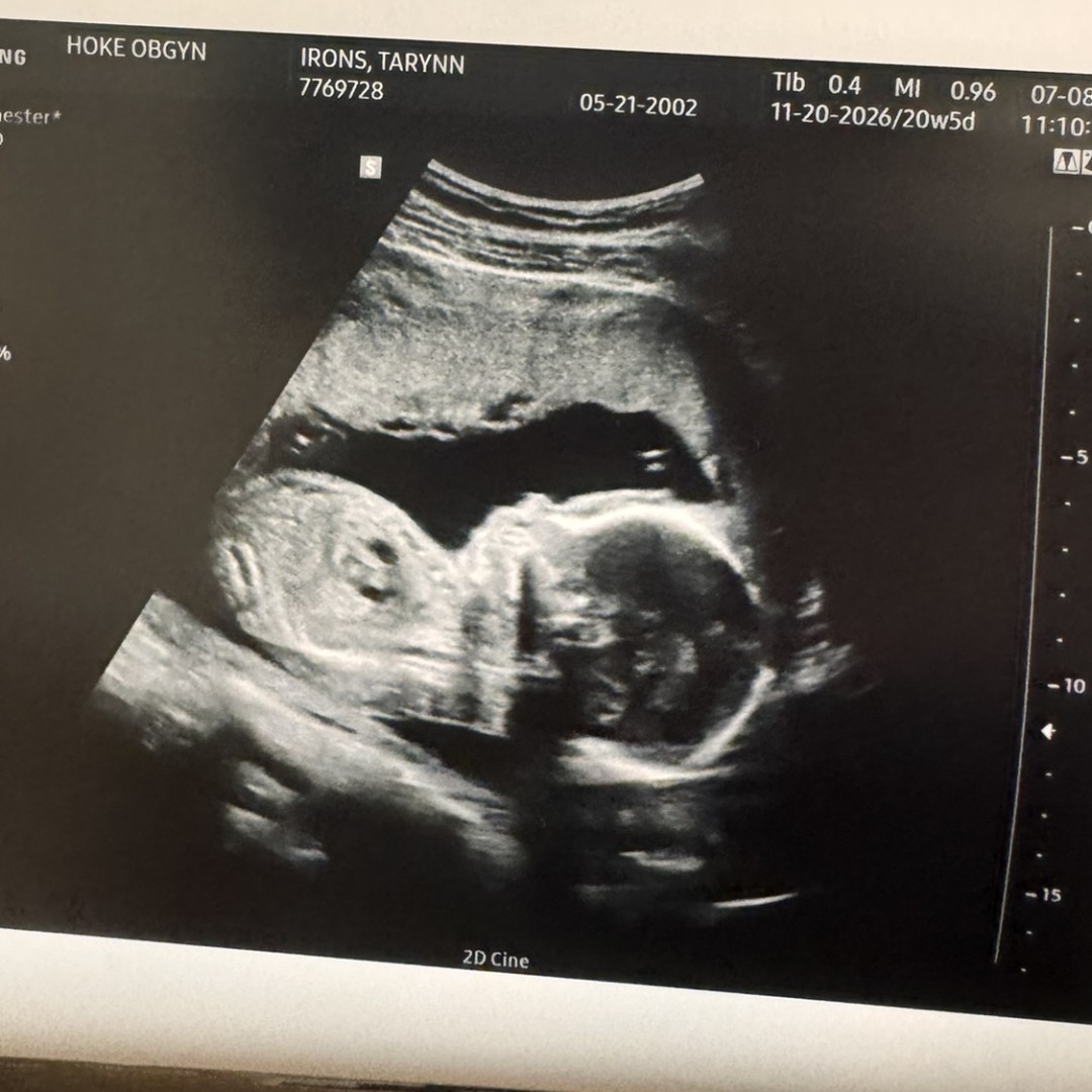 Photo shared by Tarynn for their Babylist baby registry.