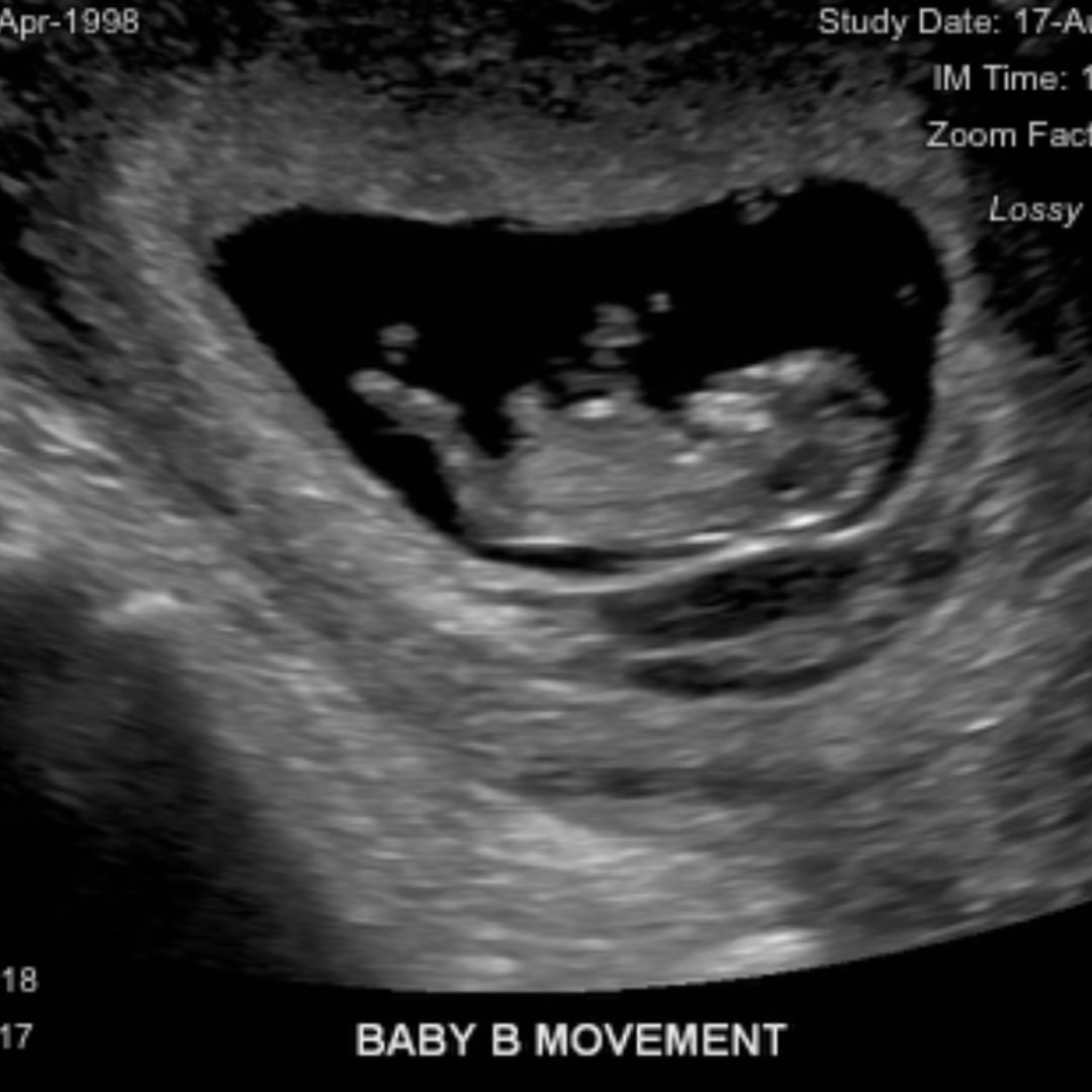 Photo shared by Jasmine for their Babylist baby registry.