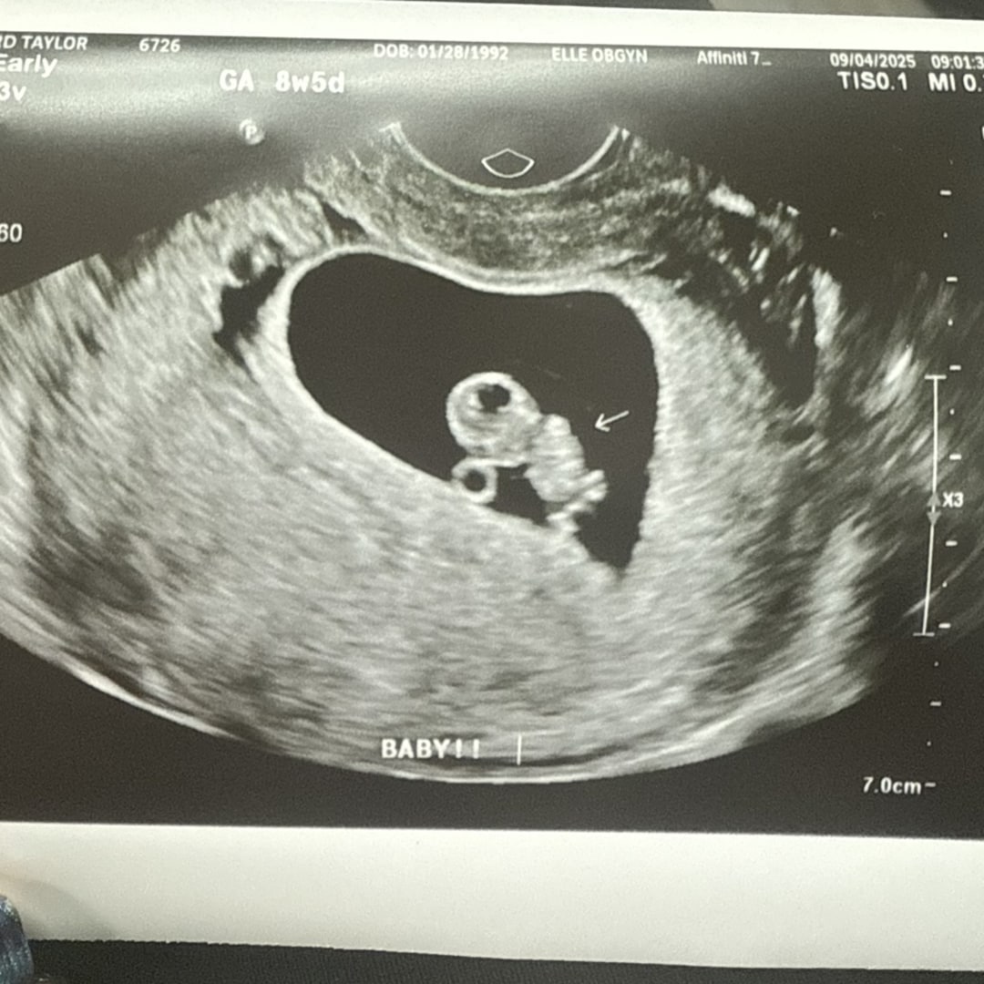 Photo shared by Taylor for their Babylist baby registry.