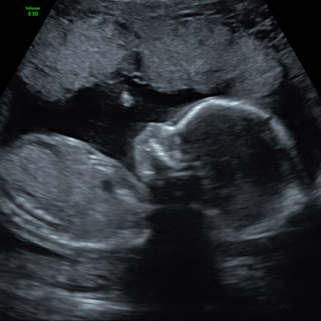 Photo shared by Emma for their Babylist baby registry.