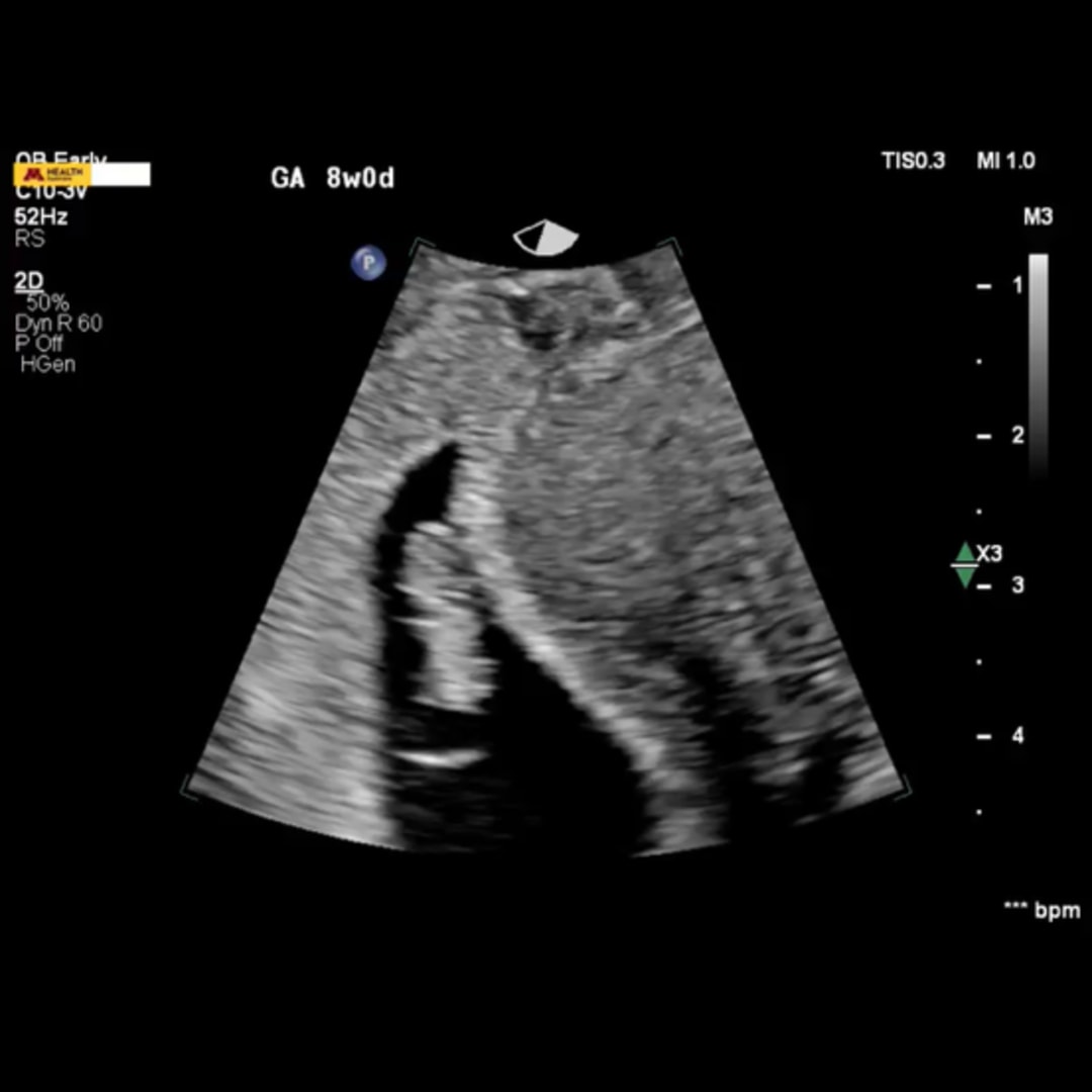 Photo shared by Makayla for their Babylist baby registry.