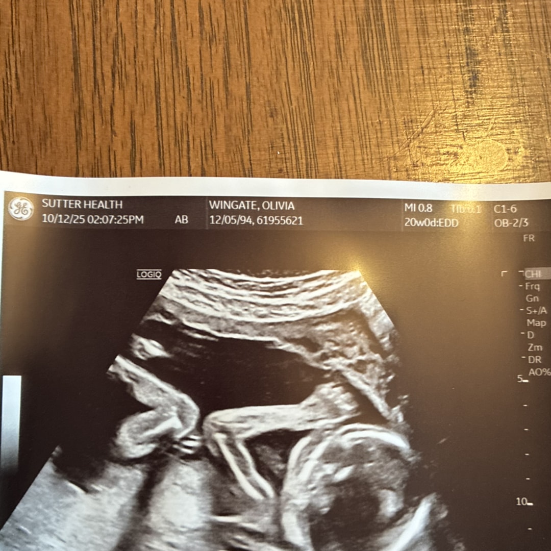 Photo shared by Olivia for their Babylist baby registry.