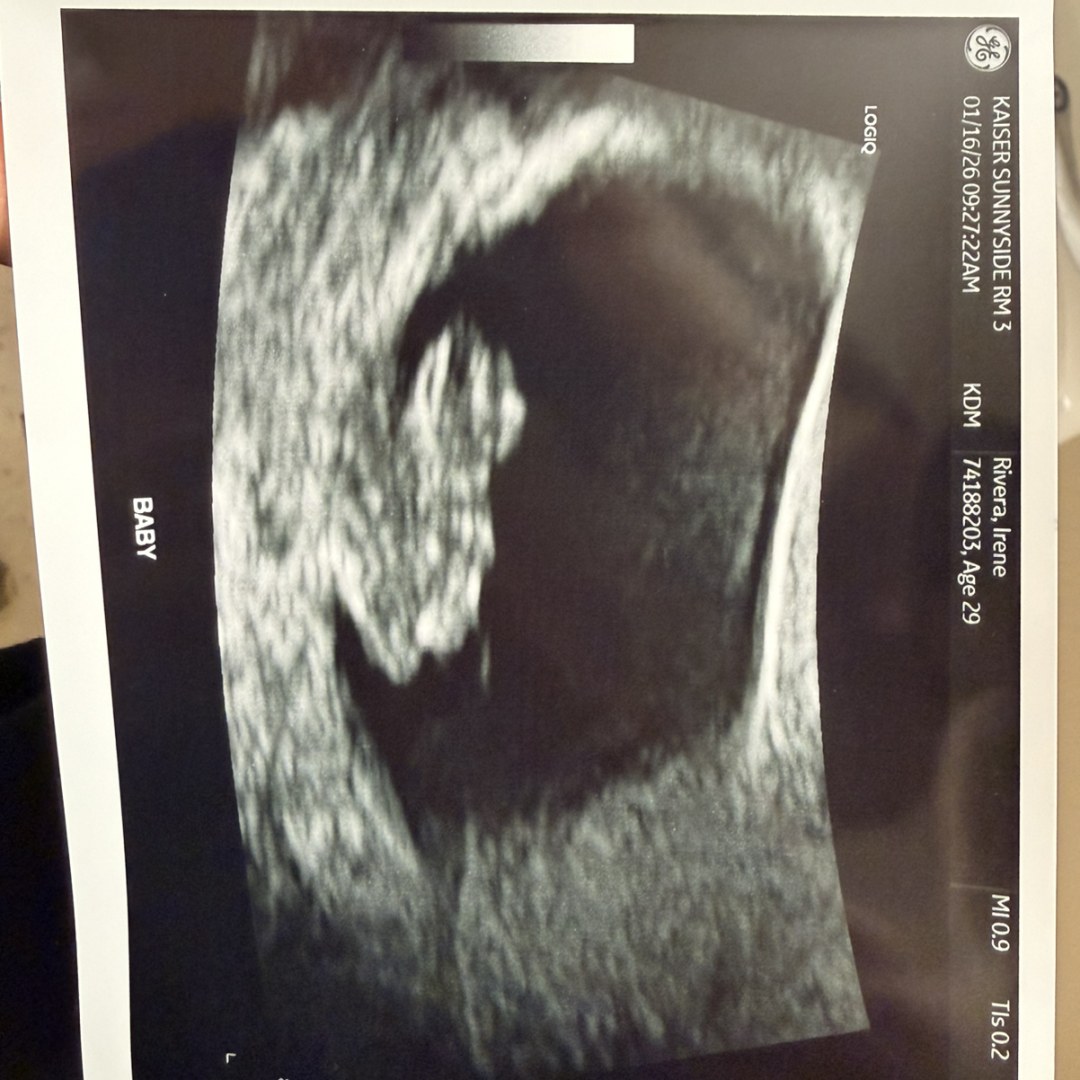 Photo shared by Irene for their Babylist baby registry.