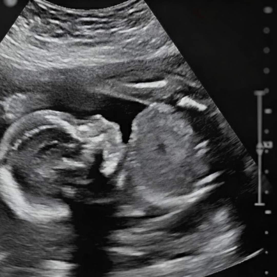 Photo shared by Trenda for their Babylist baby registry.