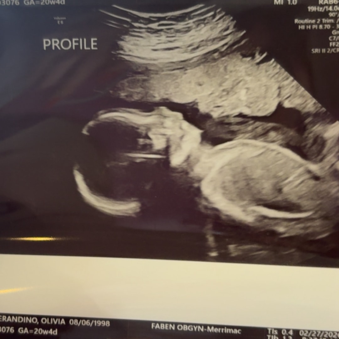 Photo shared by Olivia for their Babylist baby registry.