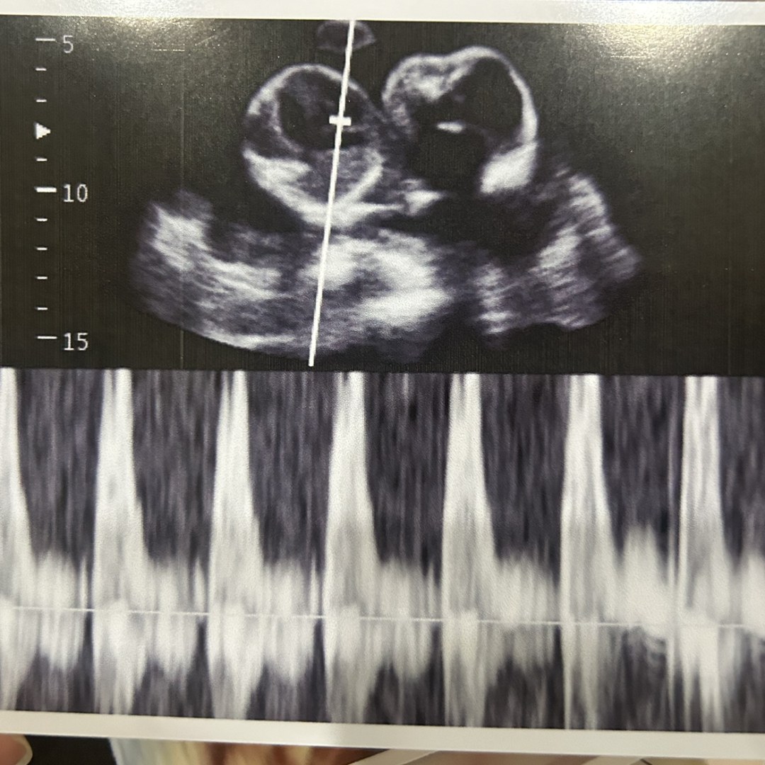 Photo shared by Emily for their Babylist baby registry.
