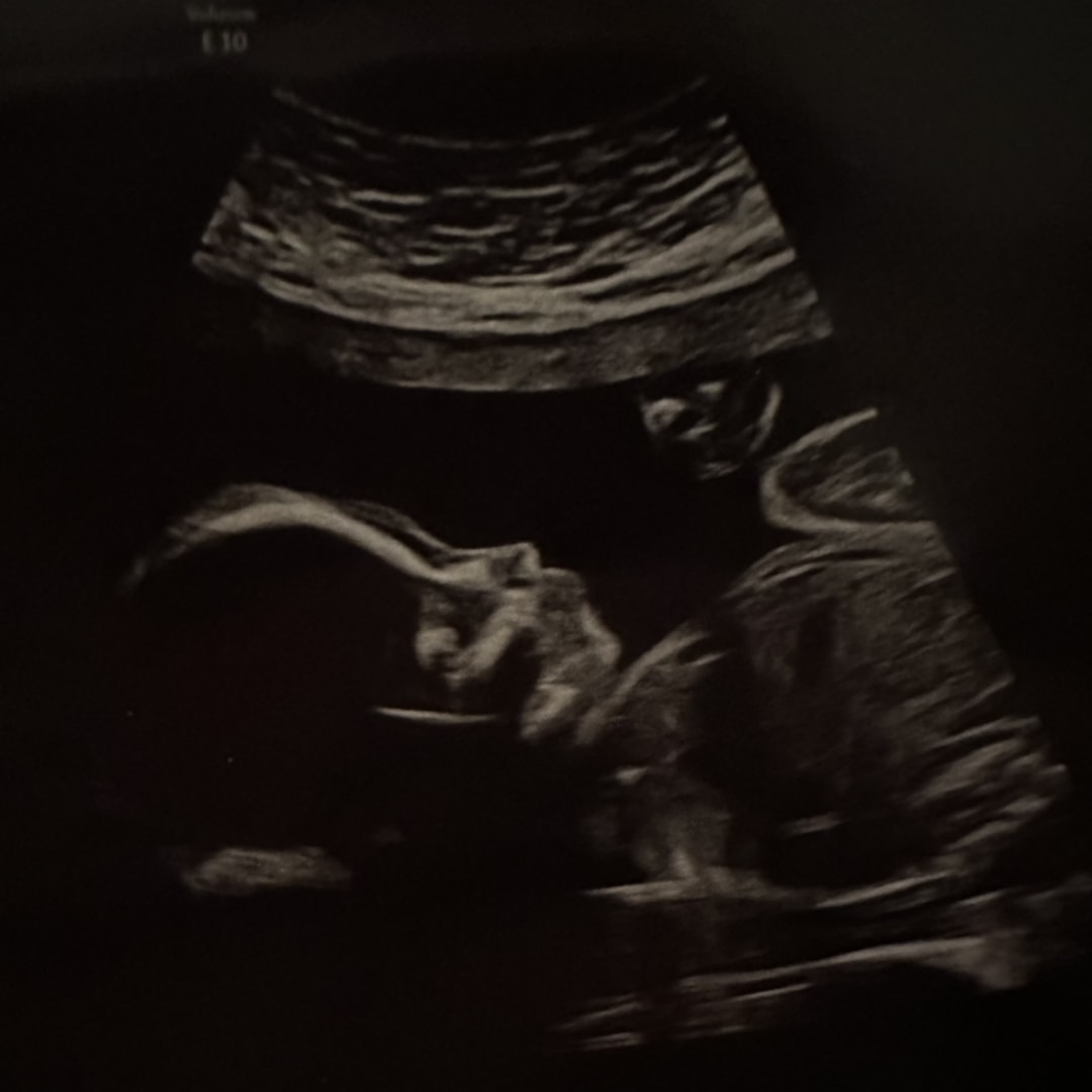 Photo shared by Chloe for their Babylist baby registry.