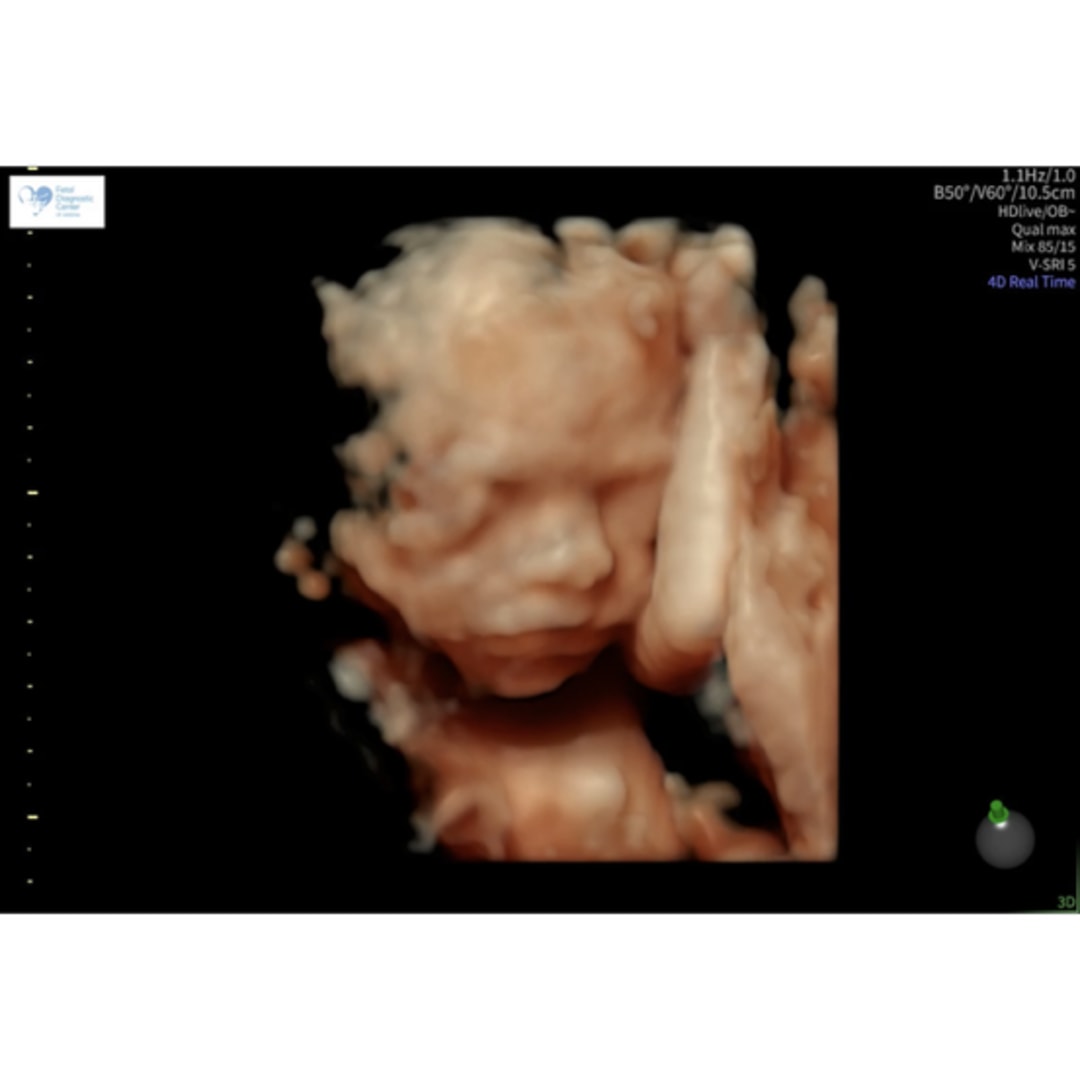 Photo shared by Grant for their Babylist baby registry.