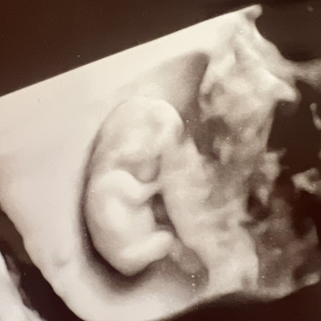 Photo shared by Sarah for their Babylist baby registry.