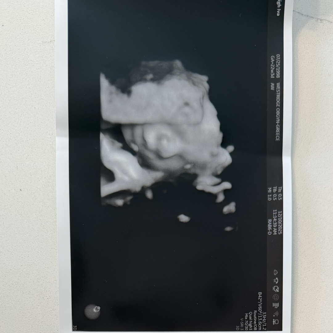 Photo shared by Haleigh for their Babylist baby registry.