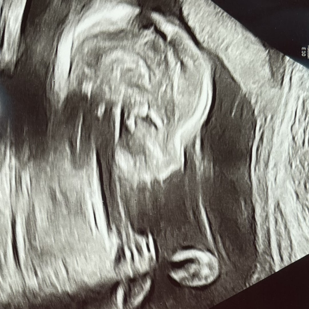 Photo shared by Kalene for their Babylist baby registry.