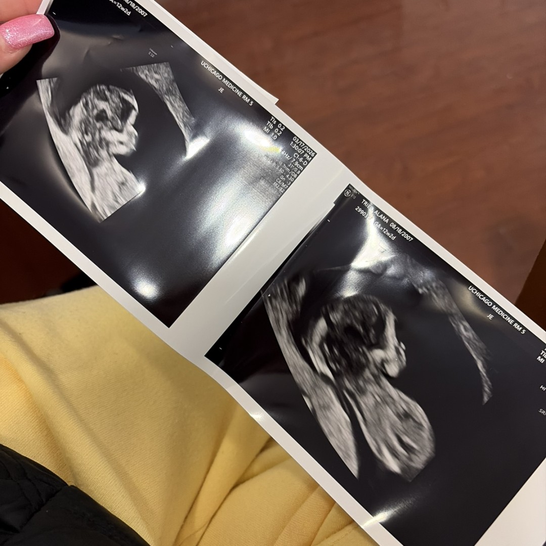 Photo shared by Alana for their Babylist baby registry.