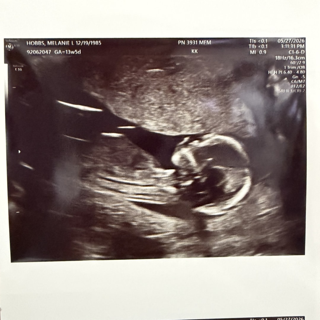 Photo shared by Melanie for their Babylist baby registry.