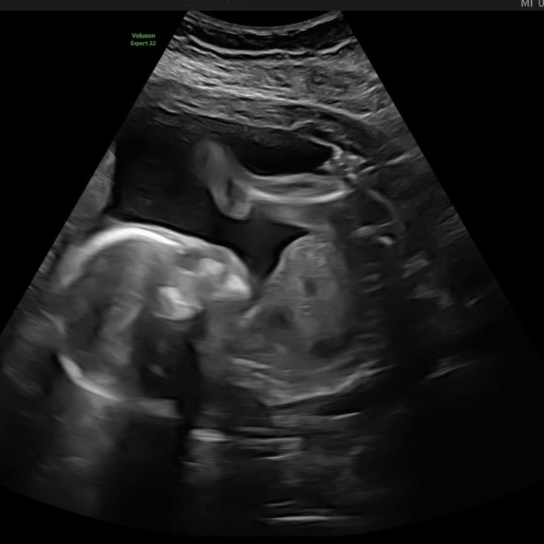 Photo shared by Charisa for their Babylist baby registry.