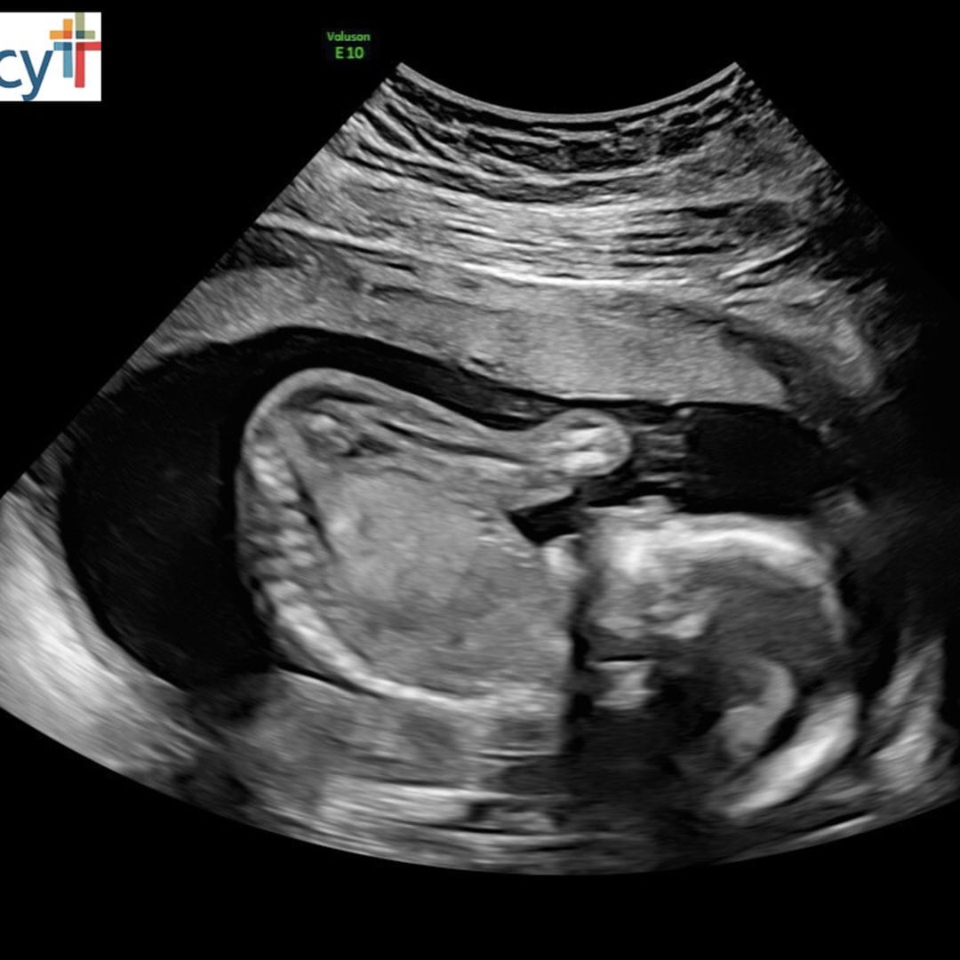 Photo shared by Katie for their Babylist baby registry.