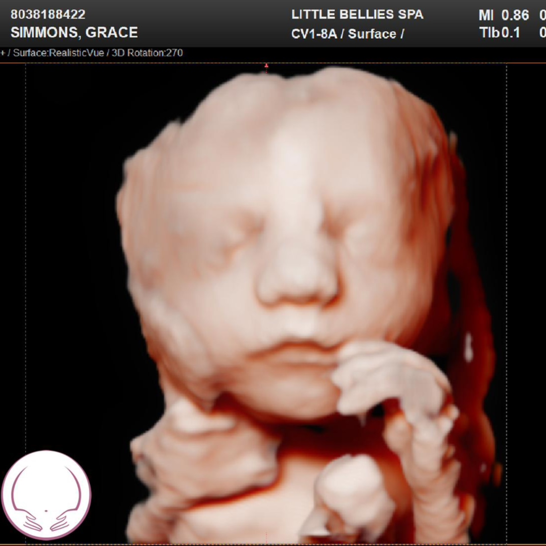 Photo shared by Grace for their Babylist baby registry.